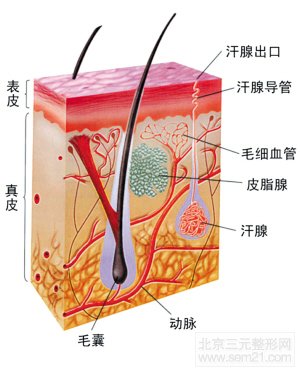 怎样去除狐臭，可以侧地根治吗？