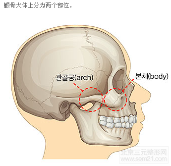 韩国颧骨缩小手术做得怎么样？