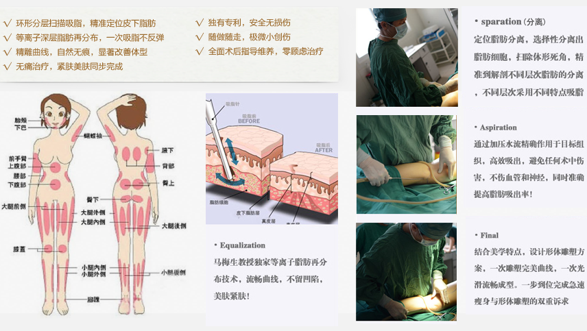 北京清木整形美容医院马梅生吸脂减肥多少钱？