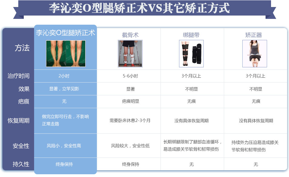 李沁奕华意o型腿矫正整形怎么样？靠谱吗？