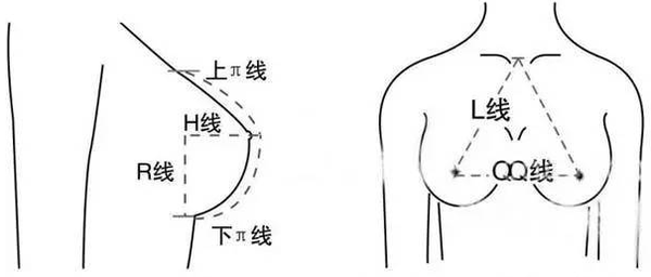 假体隆胸怎么去选择假体材料较好？