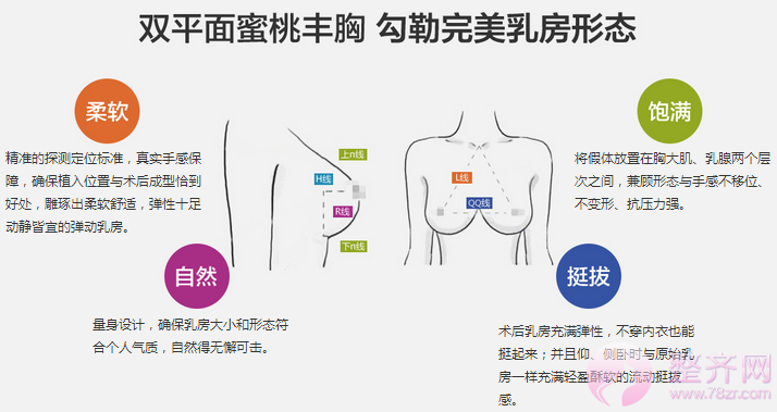 成都蜀尚蓉雅韩春隆胸怎么样？案例图？