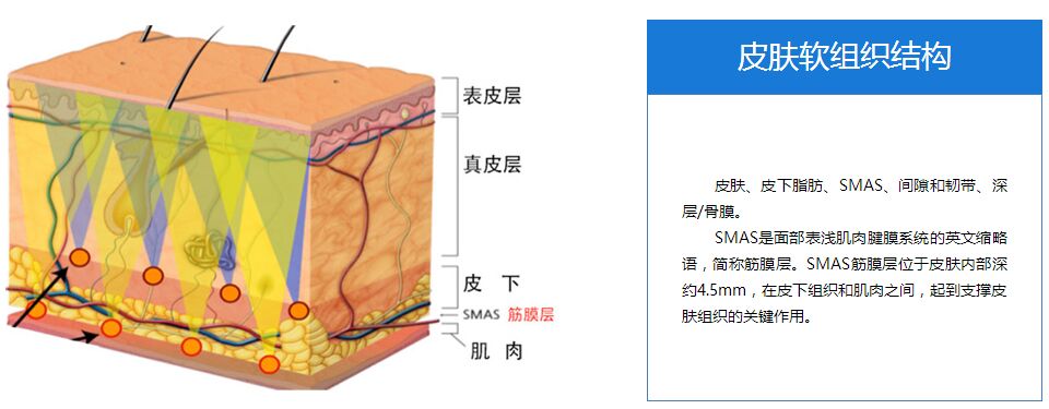 联合丽格王志军二级递进式SMAS除皱技术特点