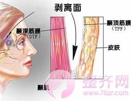 上海百达丽沈国雄隆鼻修复好不好？案例分析