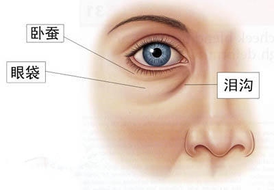 小编告诉你眼袋和卧蚕区别大