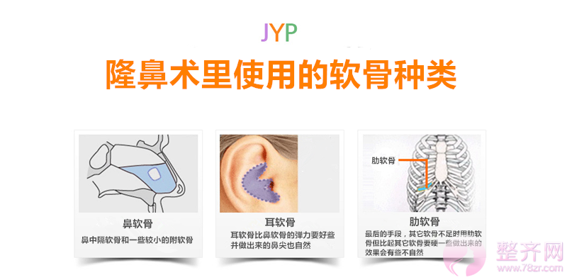 多方面解析隆鼻术