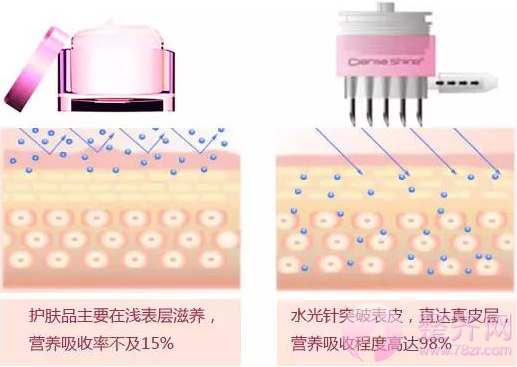 微针整形水光补水详解