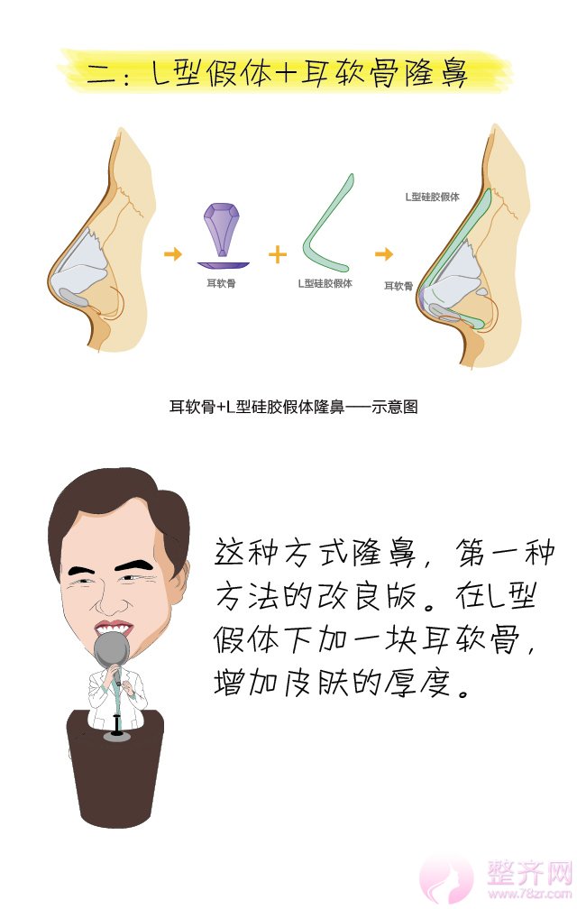 巫文云隆鼻观，鼻整形大讲堂