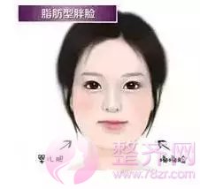 如何拥有美丽迷人小脸