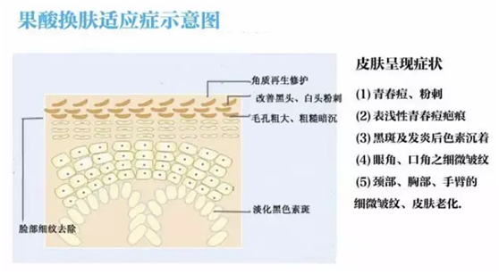 果酸换肤原理、果、副作用和危害详解