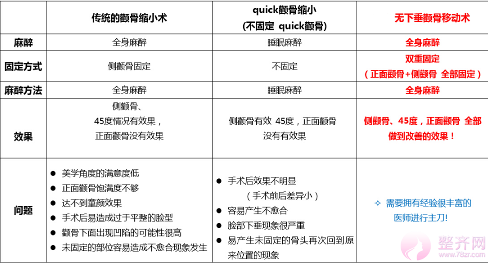 什么是无下垂颧骨移动术？