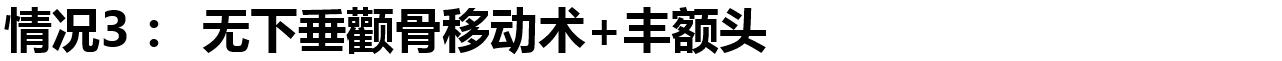 颧骨移动术手术方案