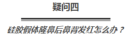 玻尿酸、假体、软骨，隆鼻选哪种更好？