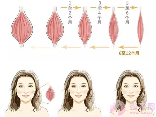 注射瘦脸的果到底有多好？！