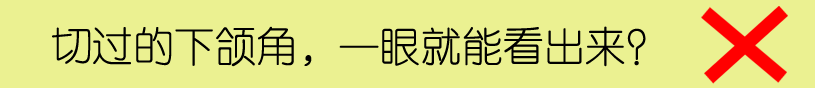 颧骨和下颌角整形手术