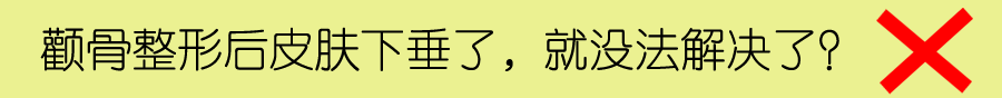 颧骨和下颌角整形手术