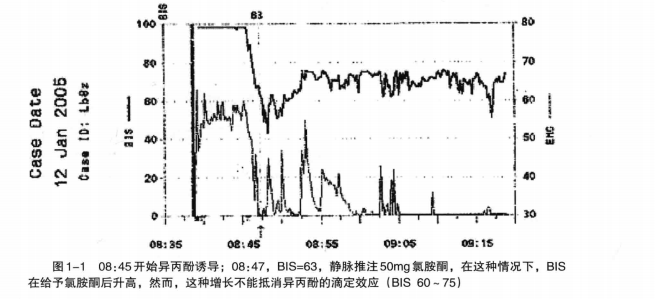 为什么微创麻醉如此重要?