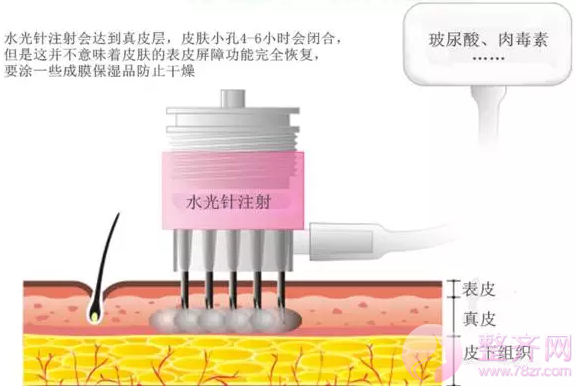 打一次水光补水当你敷8000次面膜！！！