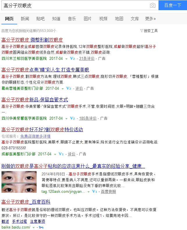 双眼皮整形手术的这20个知识点，你一定要知道