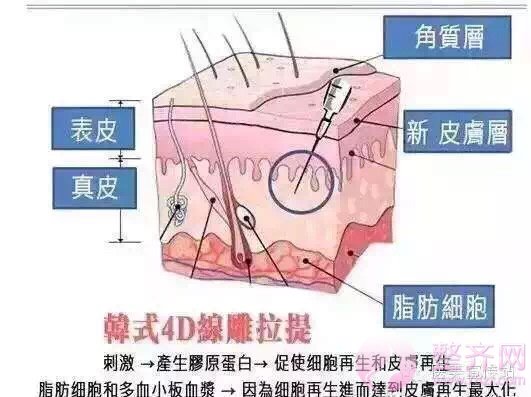 蛋白埋线提升时代已经来临！！！