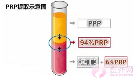 为什么需要做自体脂肪填充？