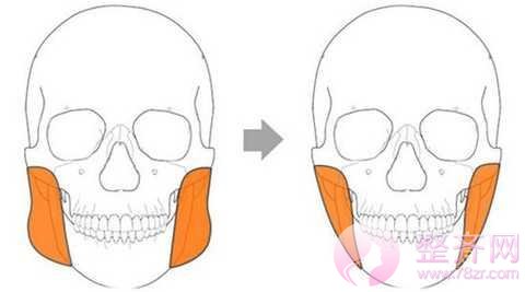 注射瘦脸瘦脸？在这之前让我们先来了解一下咬肌