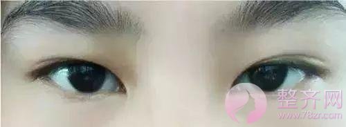 眼睑下至让你的眼睛温柔好看!
