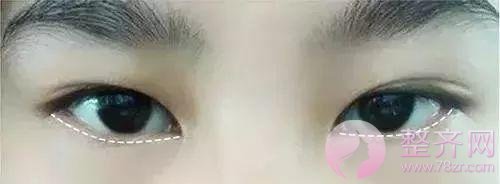 眼睑下至让你的眼睛温柔好看!
