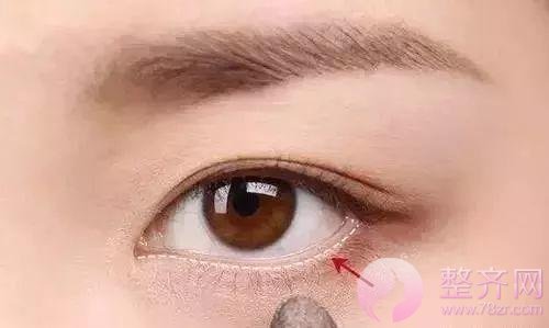 眼睑下至让你的眼睛温柔好看!