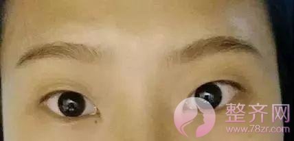 眼睑下至让你的眼睛温柔好看!