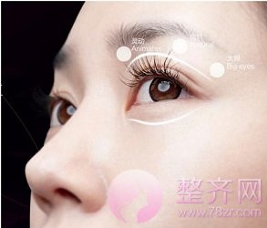 双眼皮3种术式究竟哪种较适合你呢?