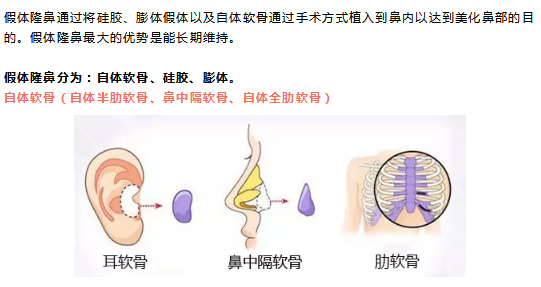 “网红鼻”的正确打开方式，美到让人心醉！