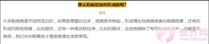 怎样才能知道自己是不是疤痕体质?