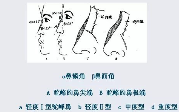 什么样的长相算是偏男相呢？主要看鼻子！