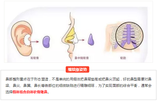 隆鼻宛如爱情，适合自己的才是较好的