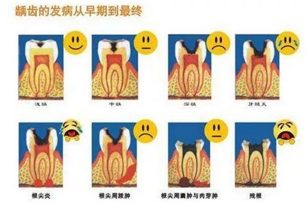 如果没有牙齿你会怎样？