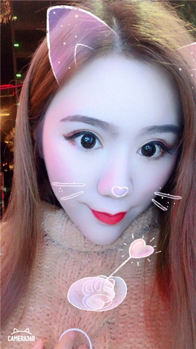 杭州美莱切开双眼皮分享，自从做了真的觉得轻松了很多，希望对大家有帮助O(∩_∩)O