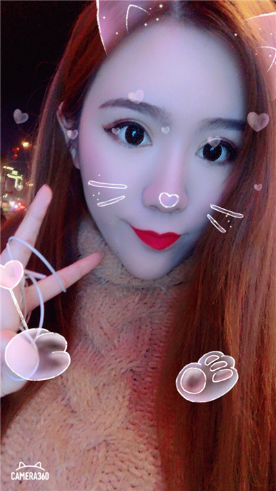杭州美莱切开双眼皮分享，自从做了真的觉得轻松了很多，希望对大家有帮助O(∩_∩)O