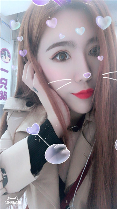 杭州美莱切开双眼皮分享，自从做了真的觉得轻松了很多，希望对大家有帮助O(∩_∩)O