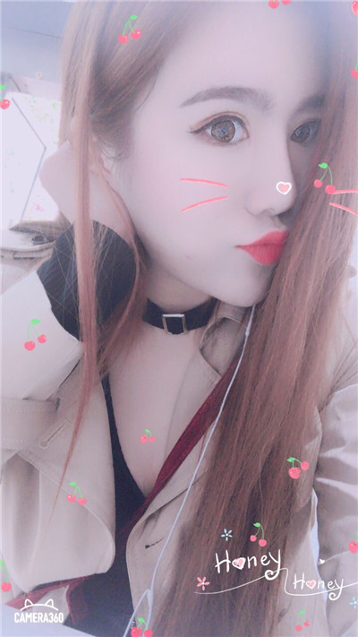 杭州美莱切开双眼皮分享，自从做了真的觉得轻松了很多，希望对大家有帮助O(∩_∩)O
