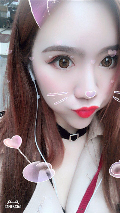 杭州美莱切开双眼皮分享，自从做了真的觉得轻松了很多，希望对大家有帮助O(∩_∩)O