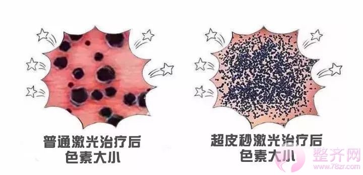 超激光美肤，带你揭开明星们的净肤秘密！