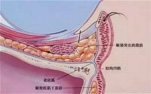 解决眼袋、黑眼圈，老阿姨秒变小姐姐