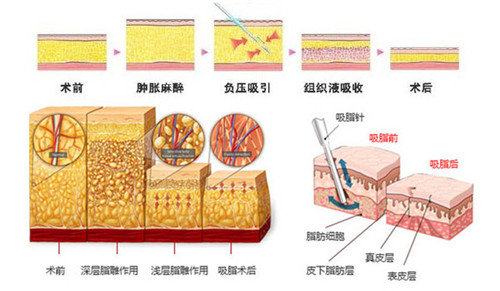 一胖毁所有，减肥真的相当于整容？