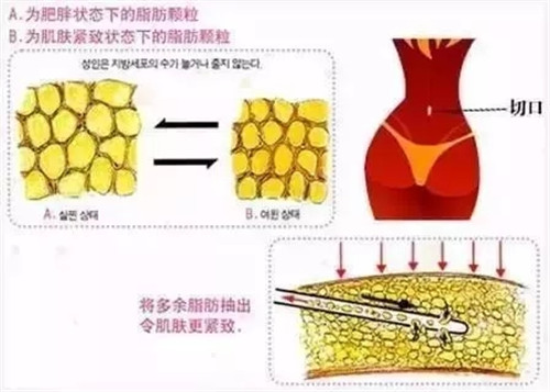 一胖毁所有，减肥真的相当于整容？