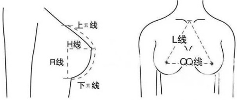 隆胸怎么选择适合自己的假体材料？