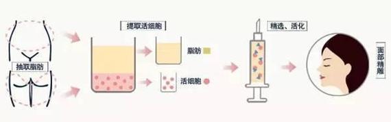 颧骨高不想磨骨，如何解决？这个攻略送给你