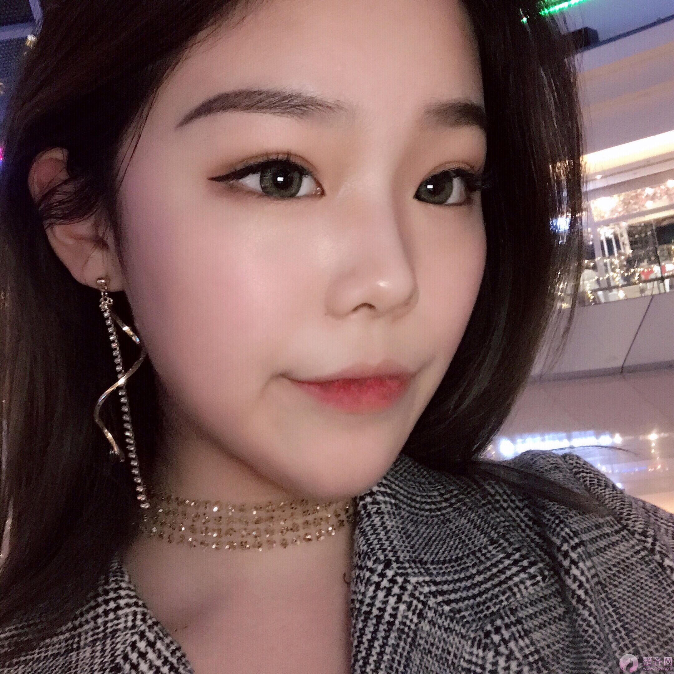 为什么那么多人热衷于下颌角手术？