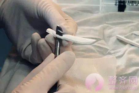 进行假体隆鼻术后，鼻尖为何发红？