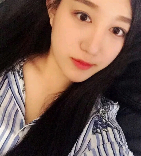 小仙女儿的鼻部手术案例分享连载（三）